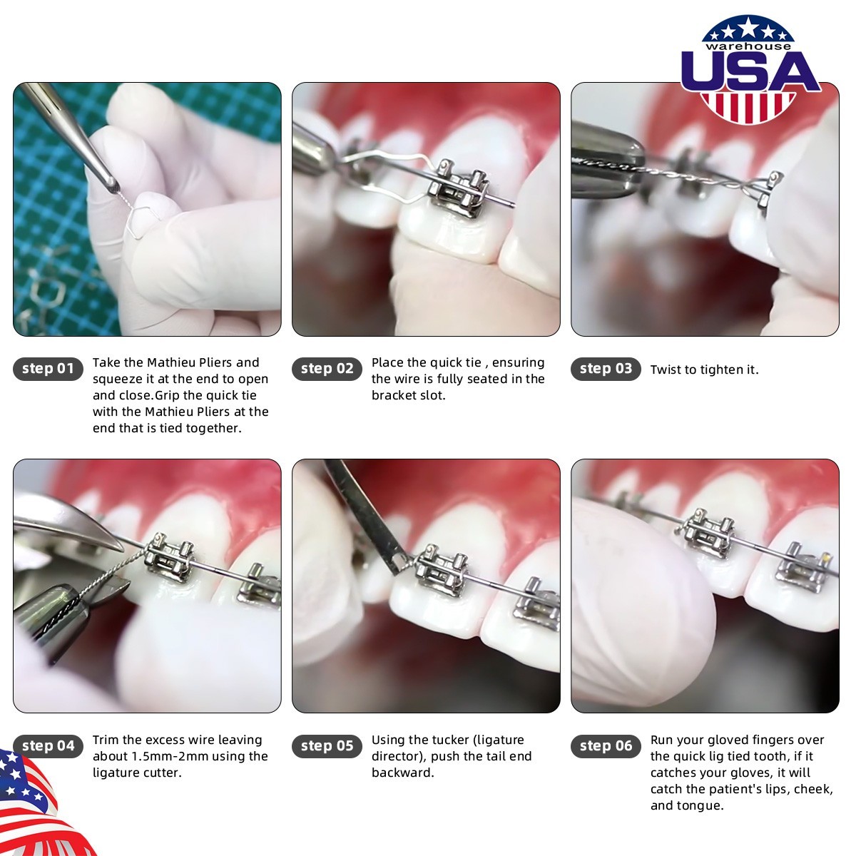 Dental Ligature Ties Orthodontic Wire Preformed Long Short Stainless Steel 100pc