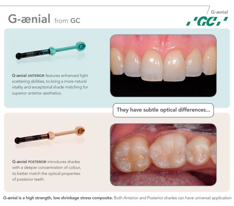Gc G-Aenial Anterior Non-Sticky High Gloss Restorative Composite Material