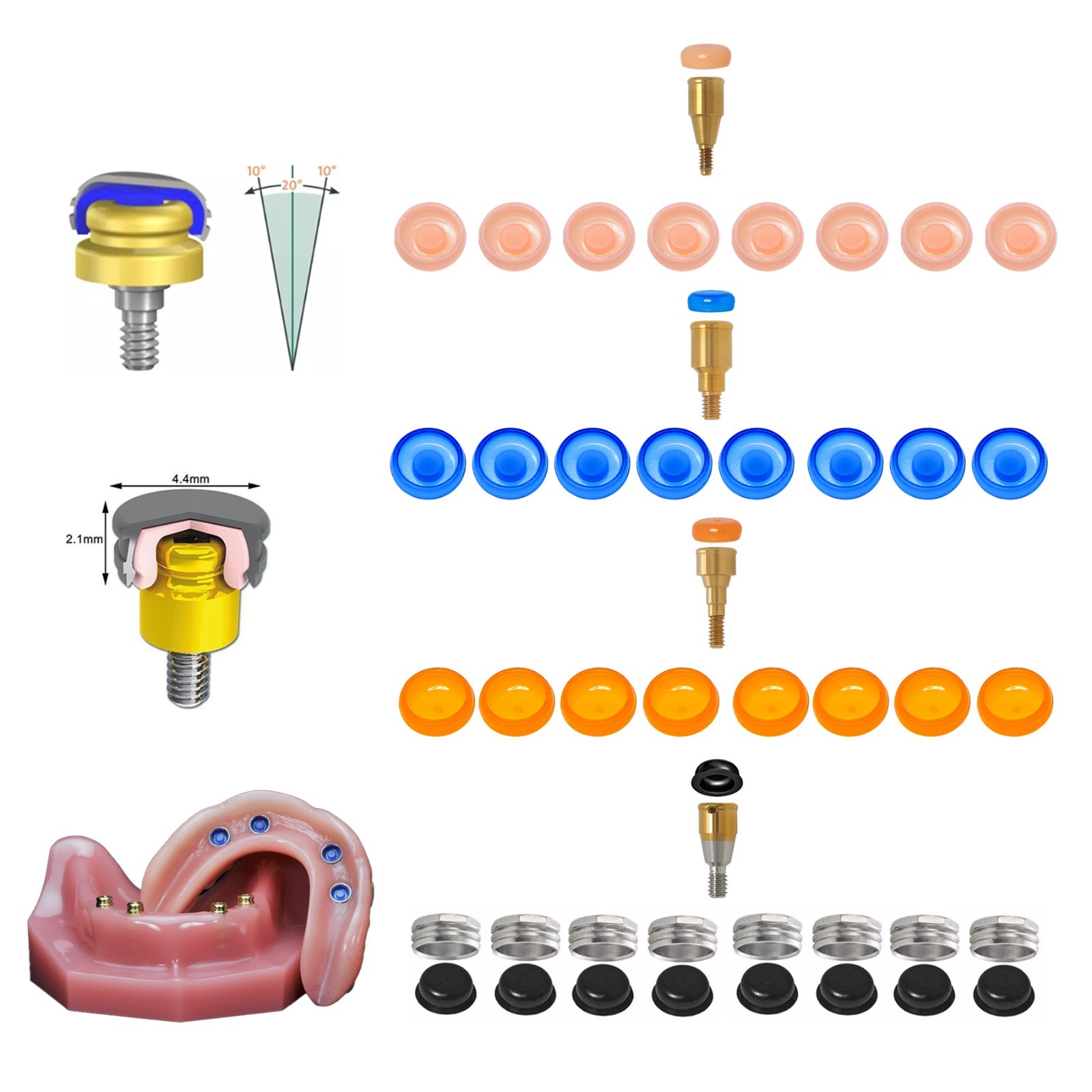 US Dental Locator Abutment Overdenture Retention Male Caps Inserts Metal Housing