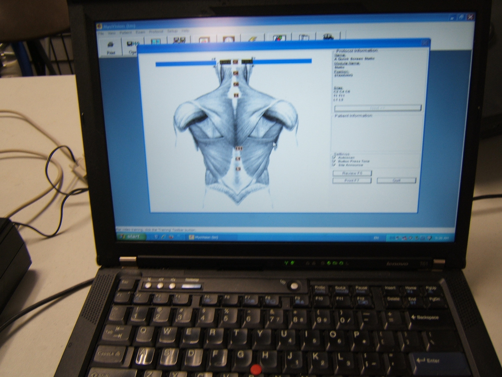 Laptop w/Validated Myovision 8000 Software Installed Ready to Use! Chiropractic.