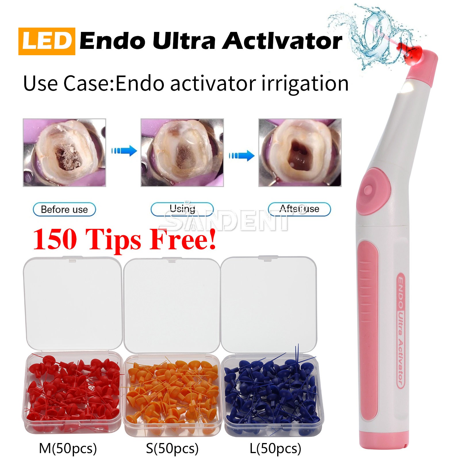 Dental Wireless Ultrasonic Activator Endo Ultra Activator with 150 Tips 3 Colors