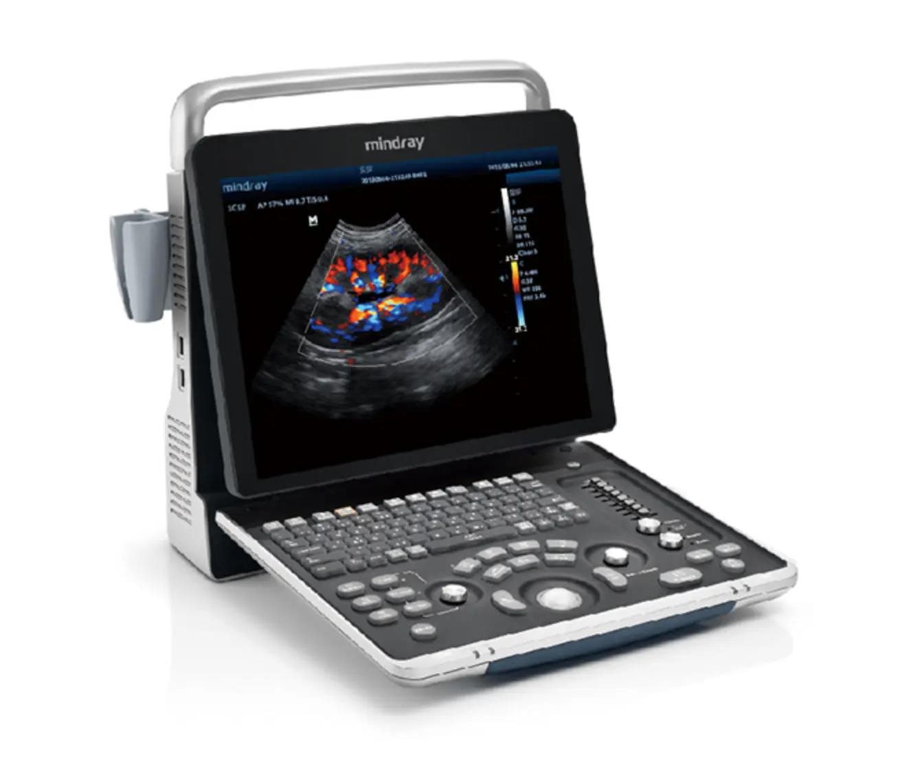 Mindray Z60 with 3 probes: phased array vascular and abdominal