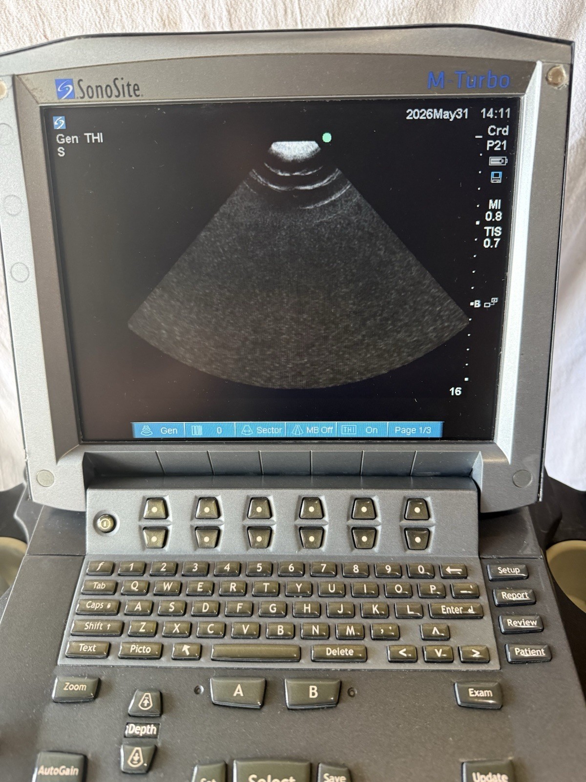 SonoSite M-Turbo Ultrasound With Cart & P21x Transducer Probe