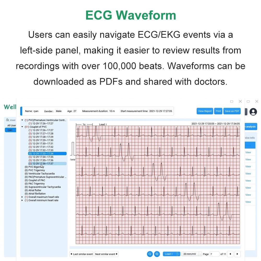 AI Analysis EKG Monitor Heart Monitor 30s/60s/5min Recording with App PC Report