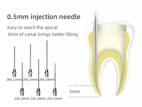Woodpecker Dental Cordless Fi-G Gutta-Percha Obturation System Gun Backfill Unit