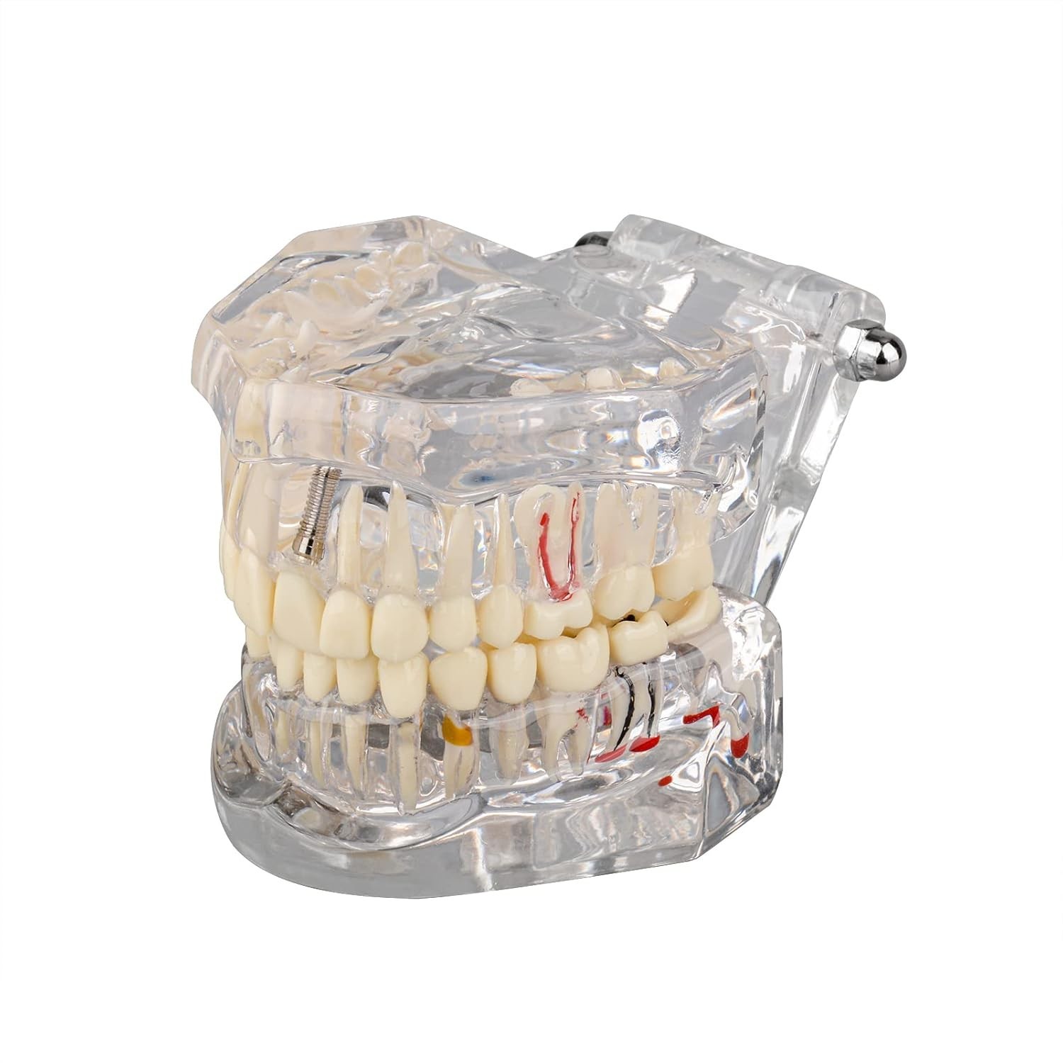 Dental Teaching Tool with Removable Teeth