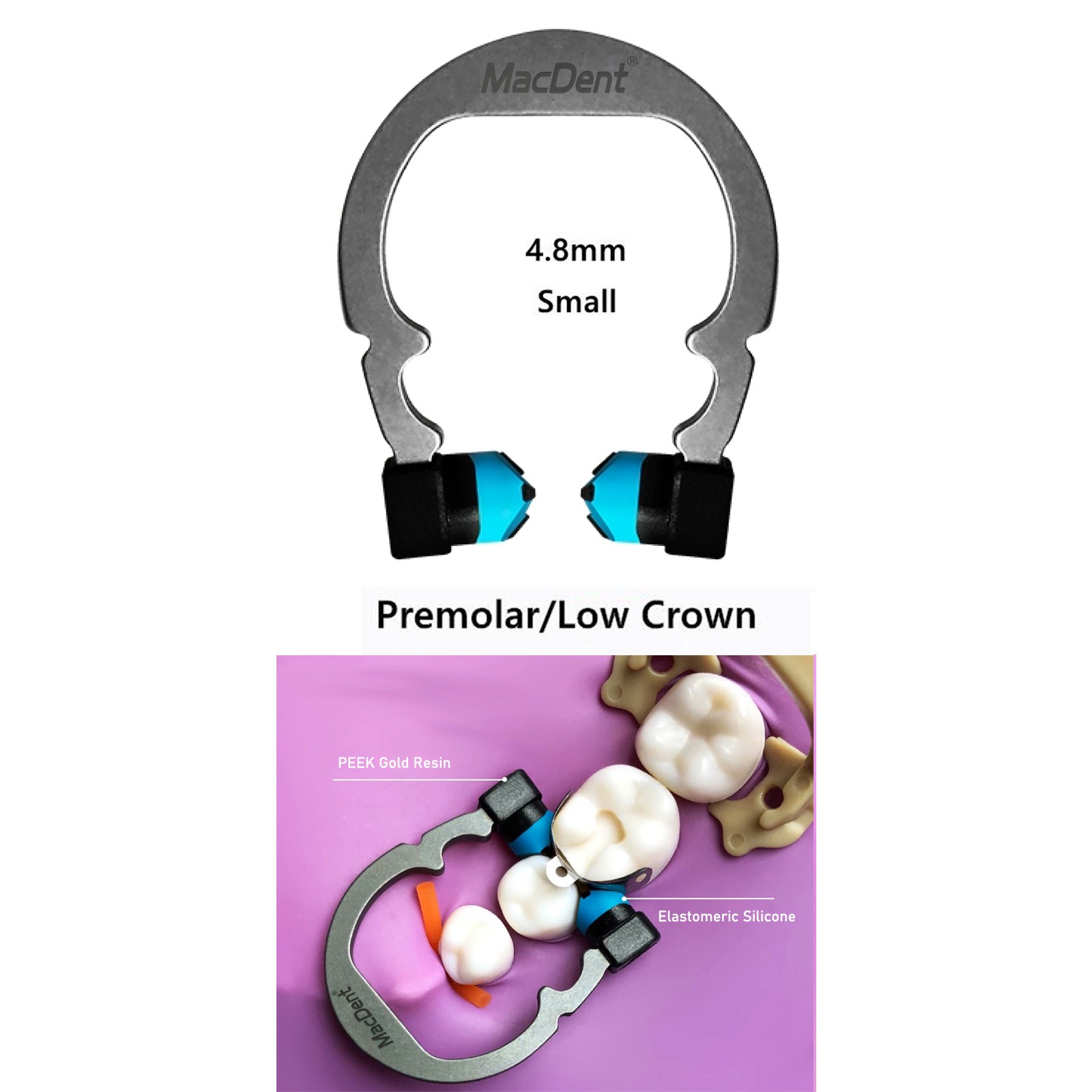 Dental Matrix Bands Ring Sectional Matrice Clamp Fit Garrison Palodent V3 System
