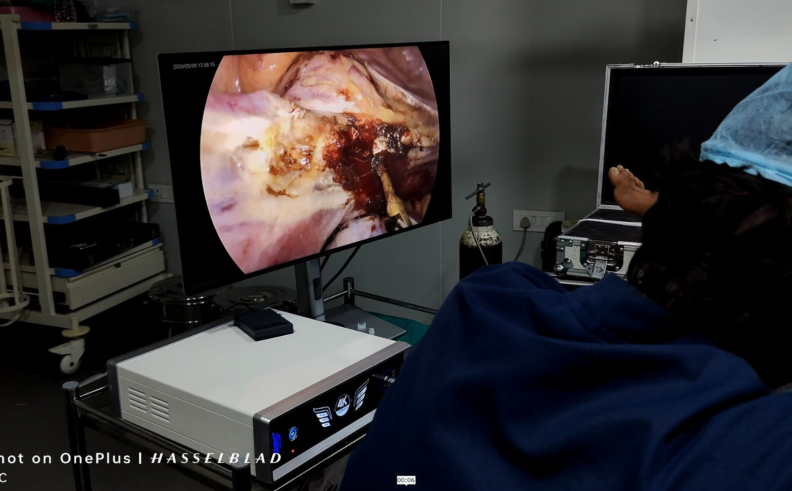 4k Endoscopy Laparoscopic Camera System UHD-LP-6000 Ultra HD Endoscope Camera