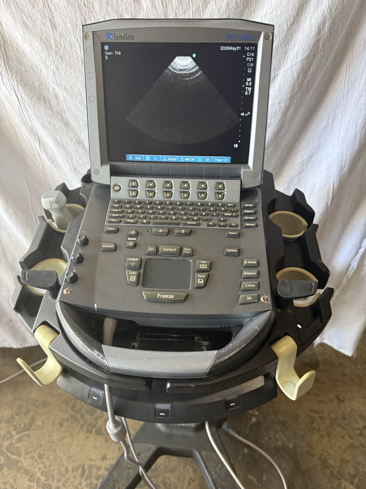 SonoSite M-Turbo Ultrasound With Cart & P21x Transducer Probe