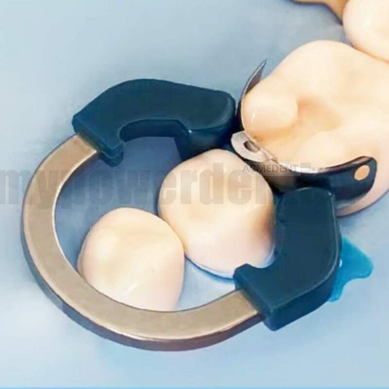 Dental Sectional Matrix Narrow Ring Titanium Clamp C2 D2 Matrix Kit Fit Palodent