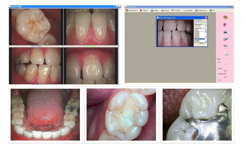 Intraoral Camera, ProDENT PD740 ,WORK With dexis,FREE US SHIPPING