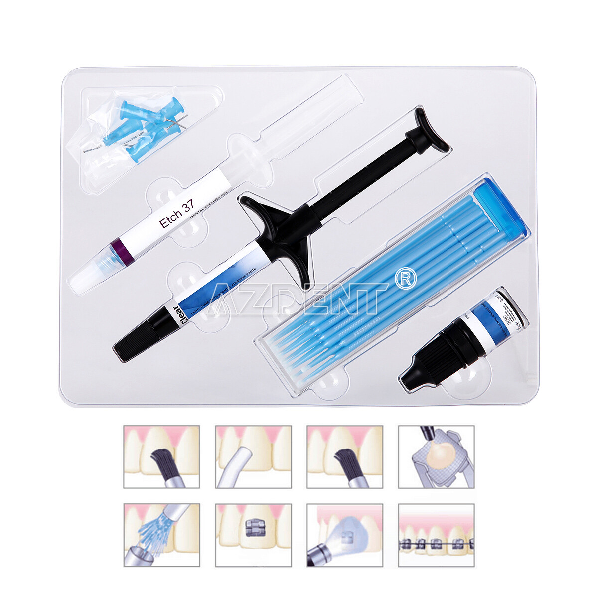 Dental Orthodontic Light Cure Adhesive Kit Blue Acid Etchant Gel for Brackets