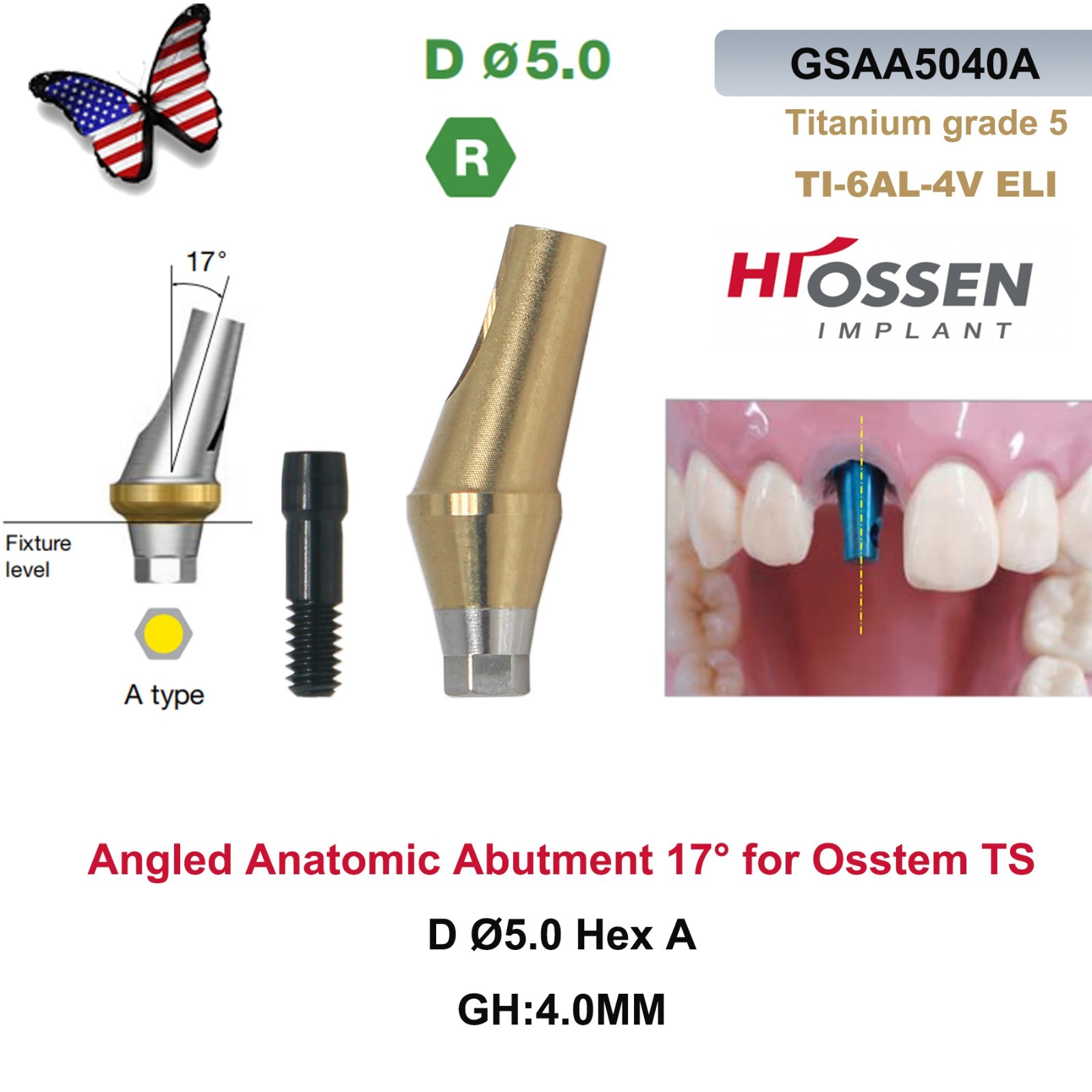 US 17° Angulated Abutment Regular Hex A/B Type For Osstem TS Regular Platform Ti