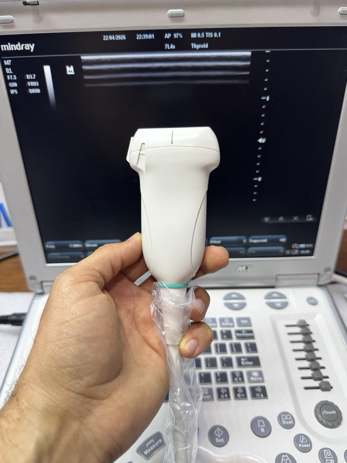 Mindray M7 With Linear Transducer 7L4S (YOU WILL RECEIVE WHAT IS IN THE PICTURE)
