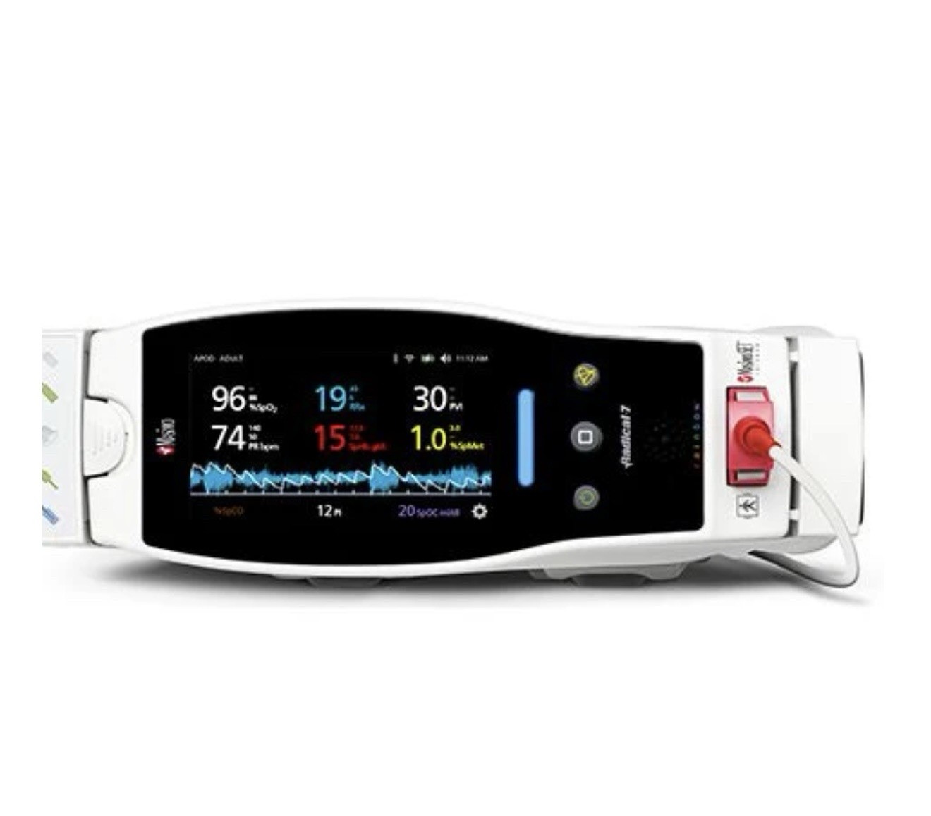 Masimo Radical-7 Pulse Oximeter