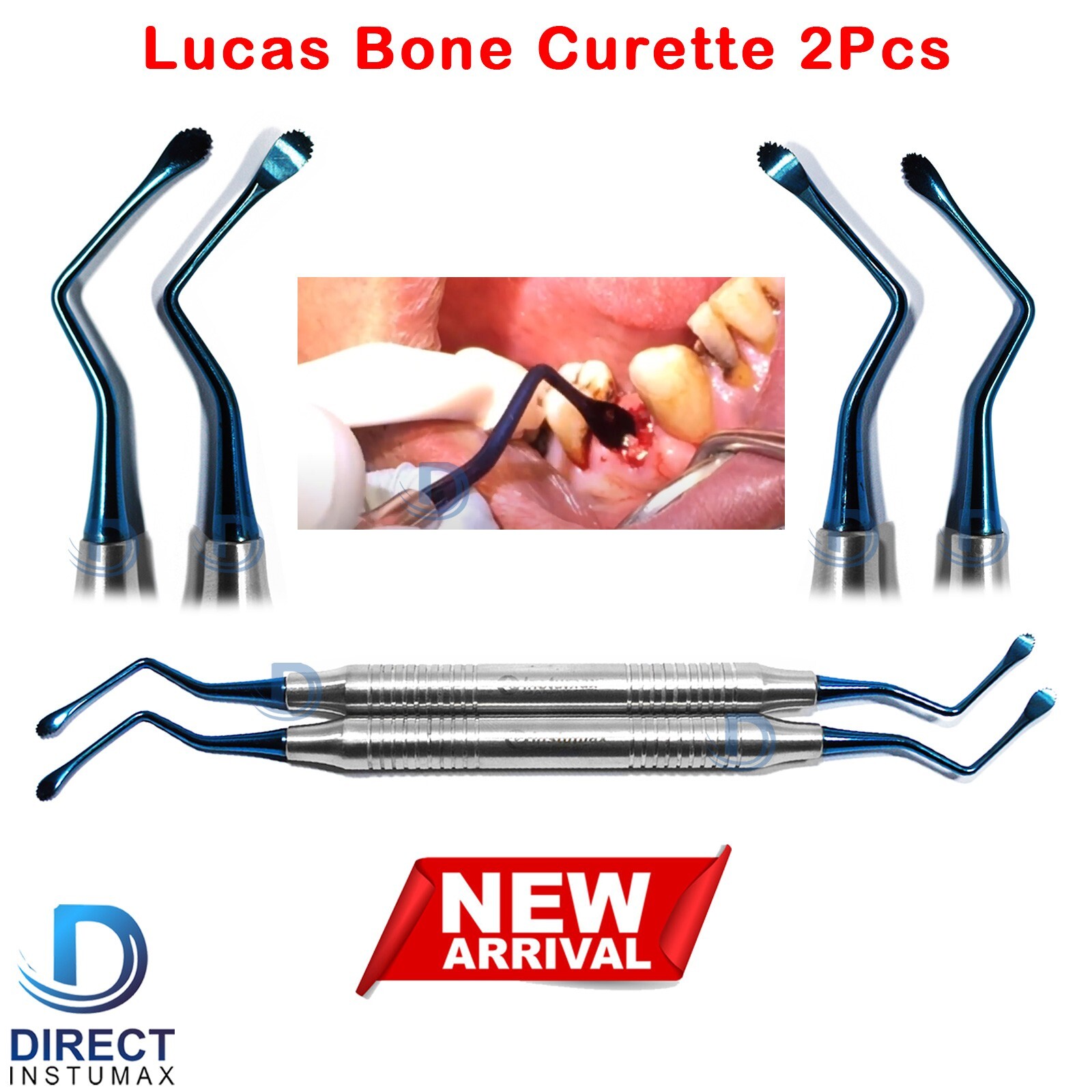 Dental Lucas Bone Curettes Set of 2 Surgical Curettes Titanium Blue Coated