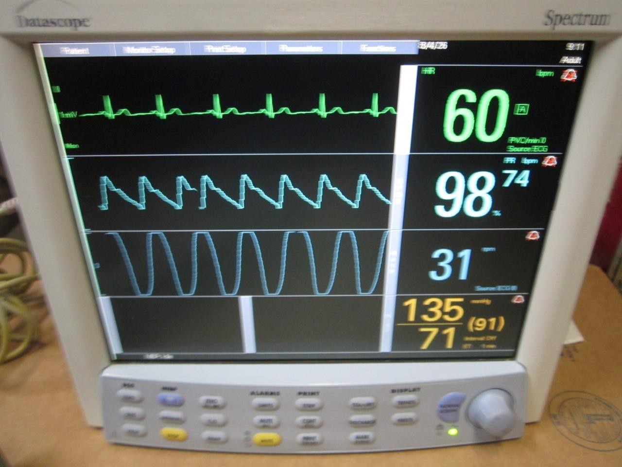 Datascope Spectrum OR Patient Monitor ECG Masimo SpO2 NIBP Printer