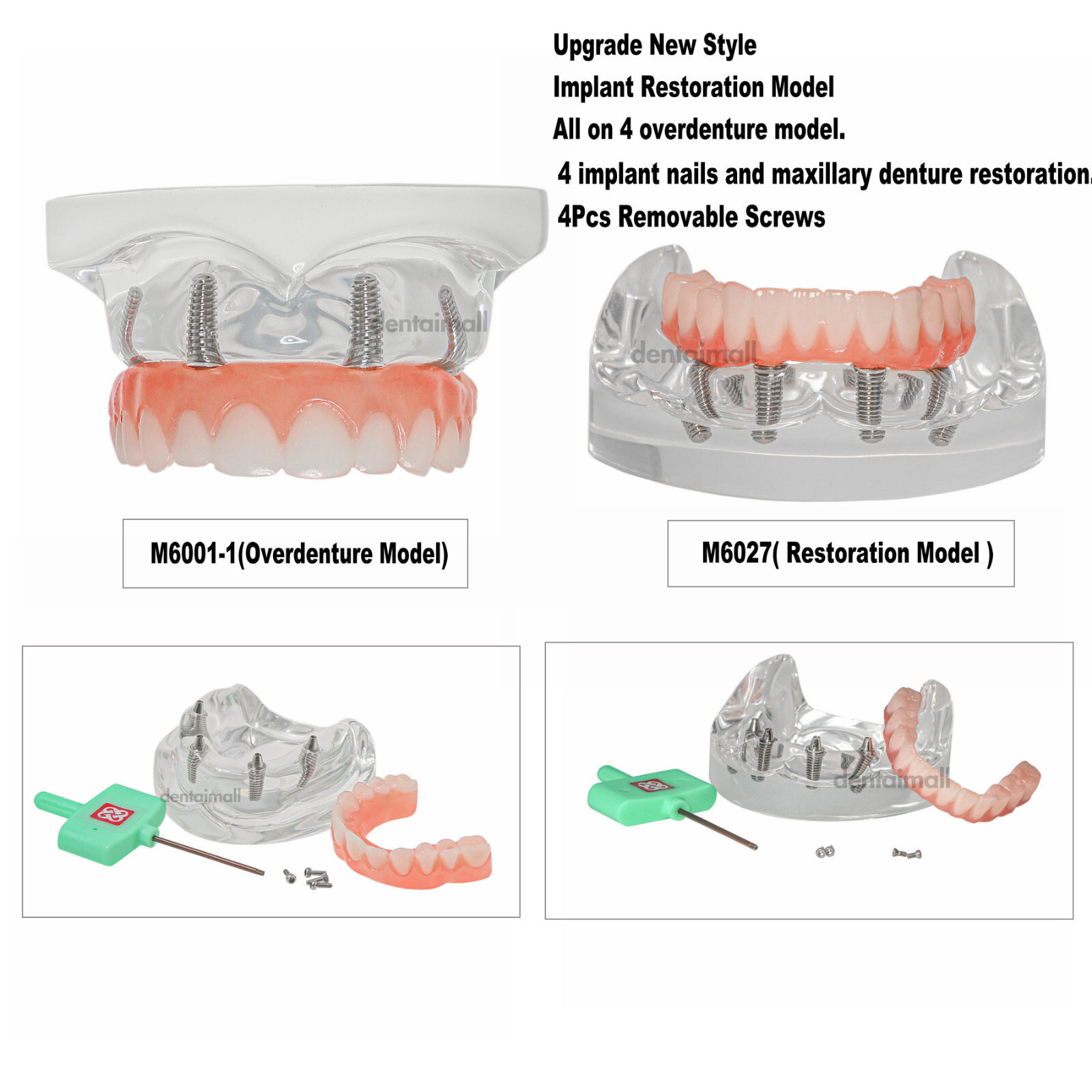 US Dental Overdenture Implant Model All-on-4 With 4 Screw Upper/Lower Clear Jaw