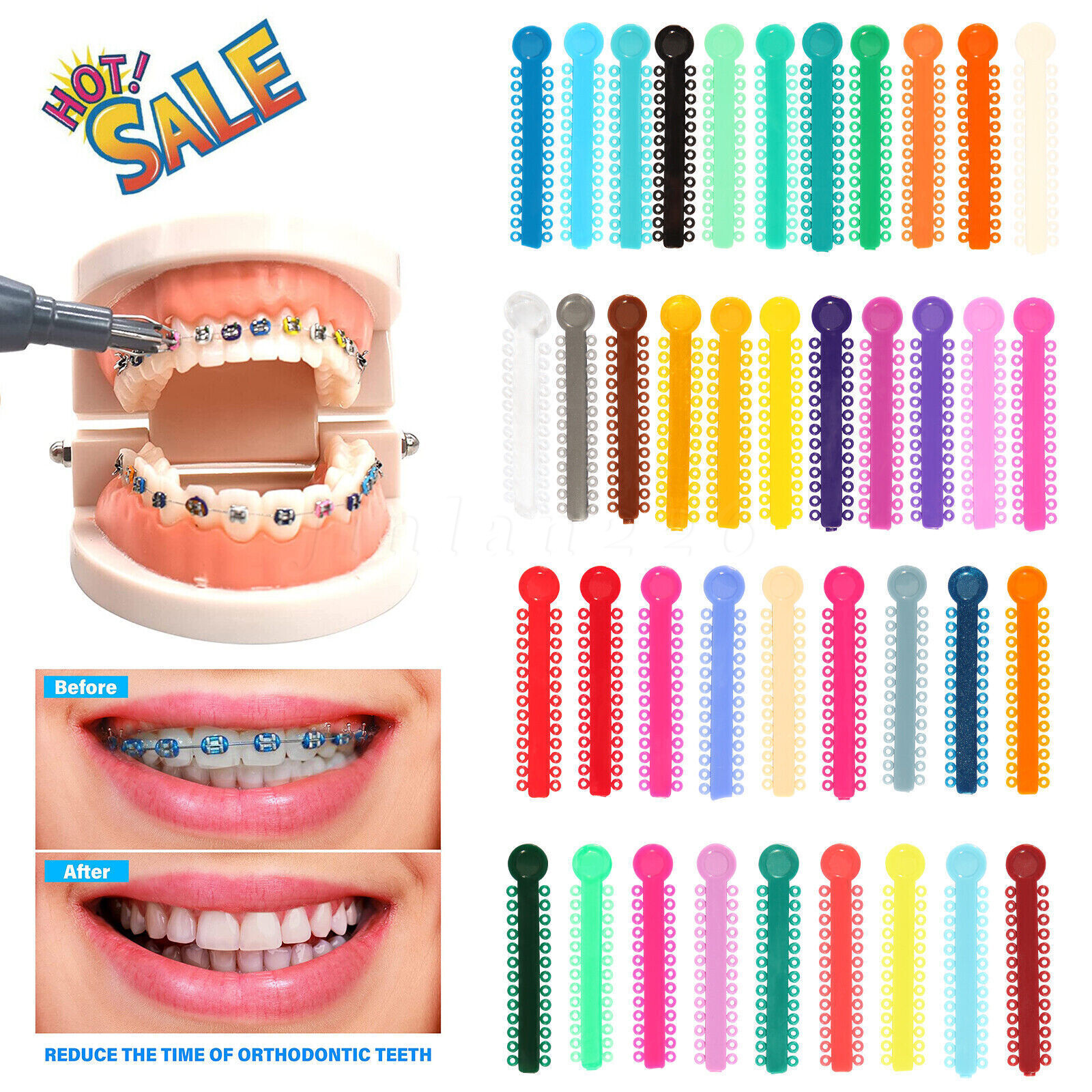 1040pcs Dental Orthodontic Ligature Ties Braces Elastic Rubber Bands 47 Colors