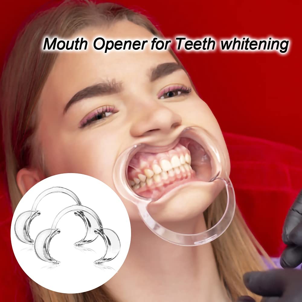 30-Pack Dental Cheek Retractor, Professional Autoclavable Mouth Opener Retractor