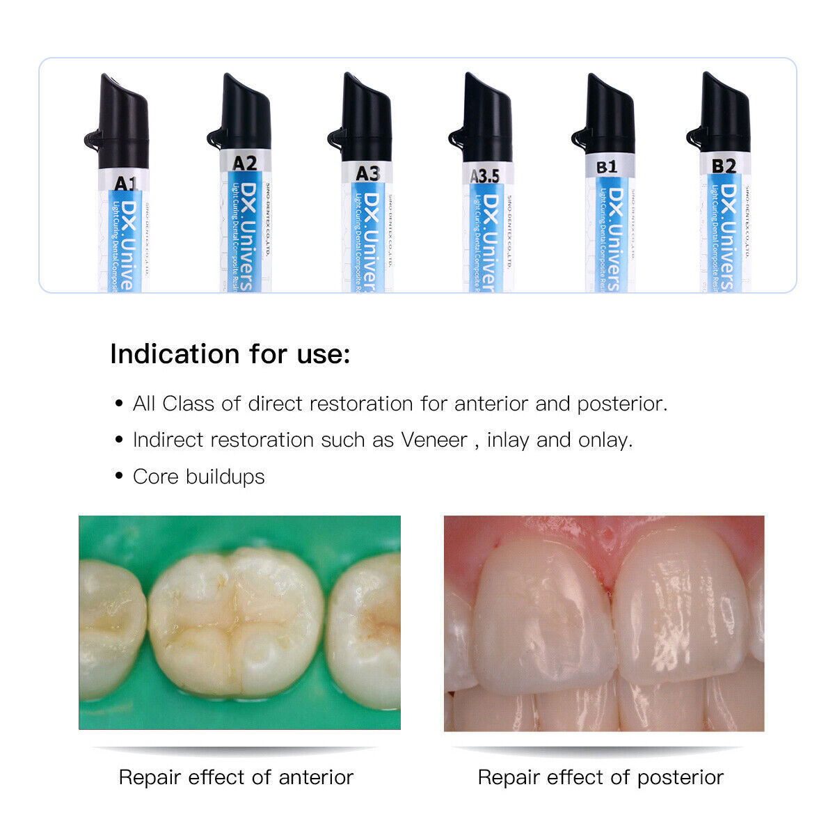 Dental Wireless LED Curing Light 1 Second Cure Lamp / Light Cure Composite Resin