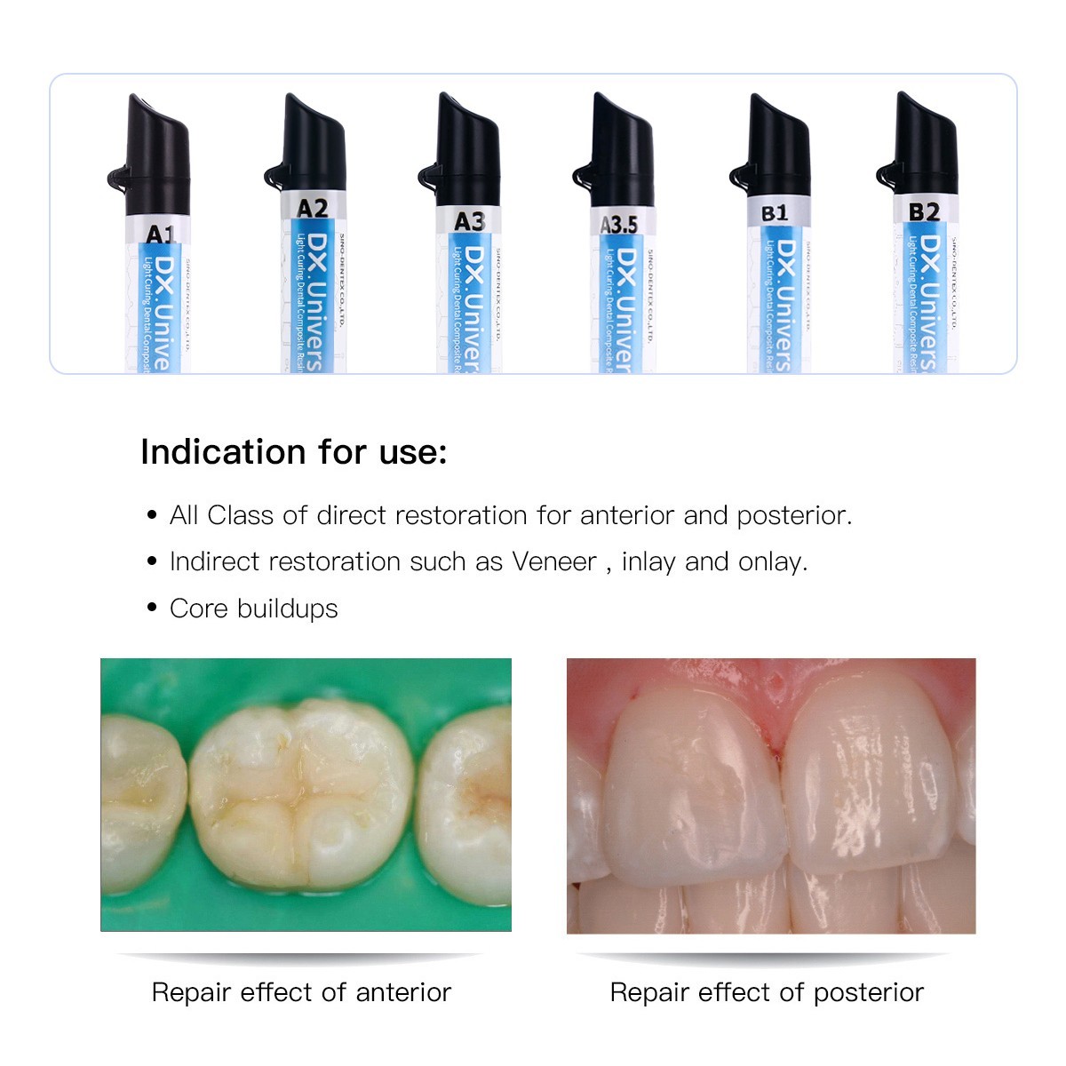 AZDENT Dental Orthodontic Intraoral Photographic Occlusal Glass Mirror 2 Sided