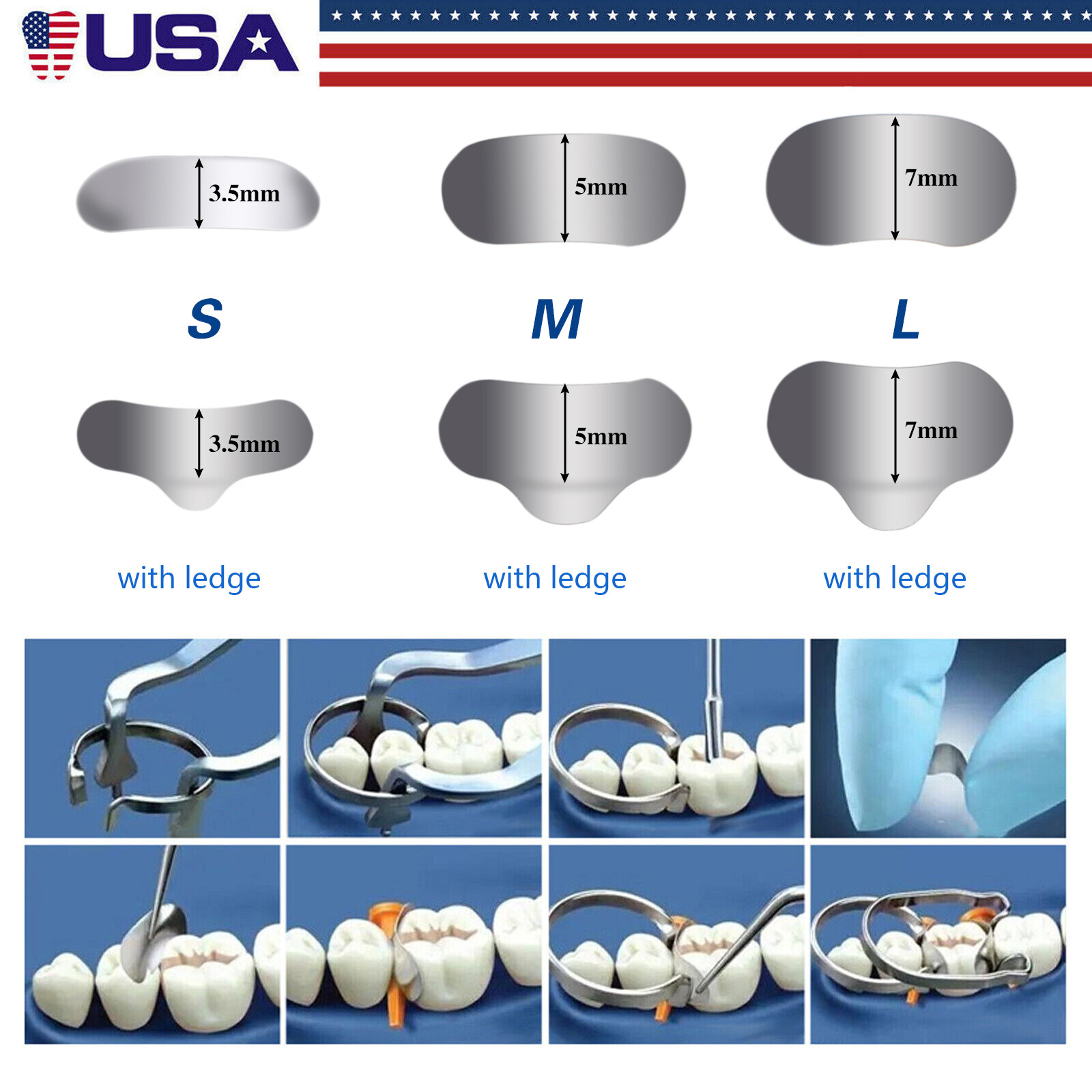 50pcs Dental Metal Matrices Matrix Sectional Contoured Refill Package 35 μm