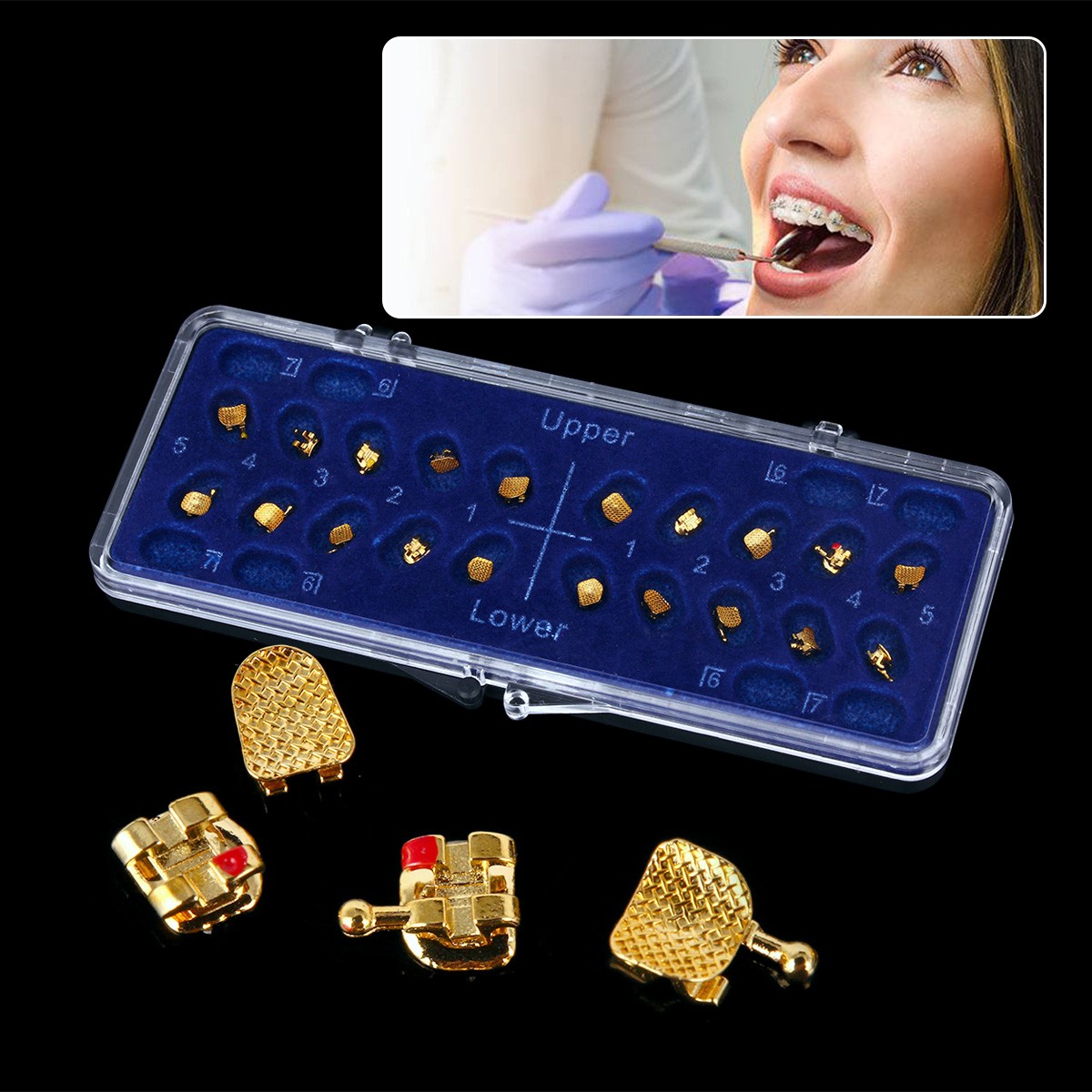 AZDENT Dental Orthodontic Brackets Braces Mini Roth/MBT 022 Hooks 345 Gold Type