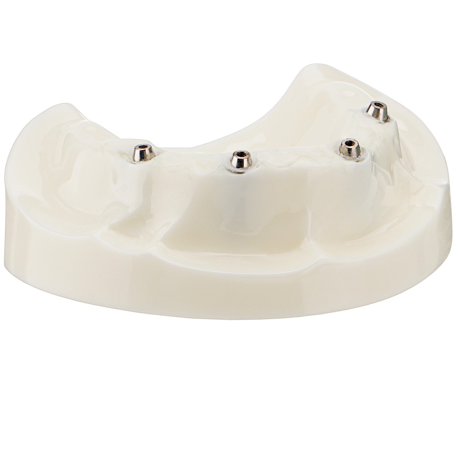 Dental All-on-4 Overdenture Model Upper Jaw Implants Restoration 4 Screws M6023