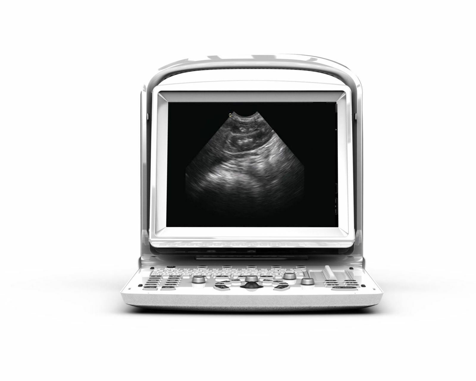 Chison ECO3 Vet Veterinary Ultrasound With Equine Rectal Probe Warranty 3 Years