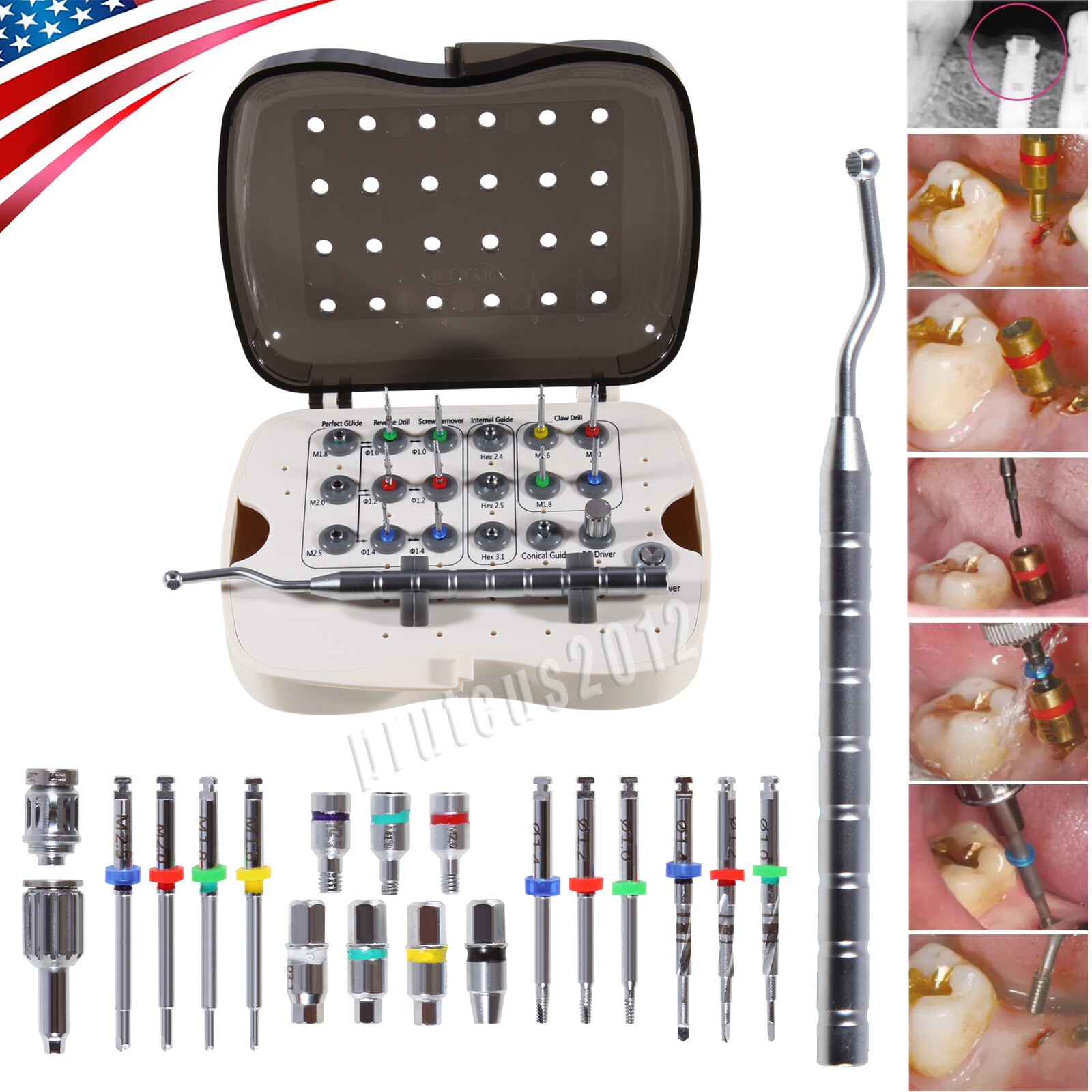 Dental Implant Broken Fractured Screw Removal Kit Drill Guide Remover USA