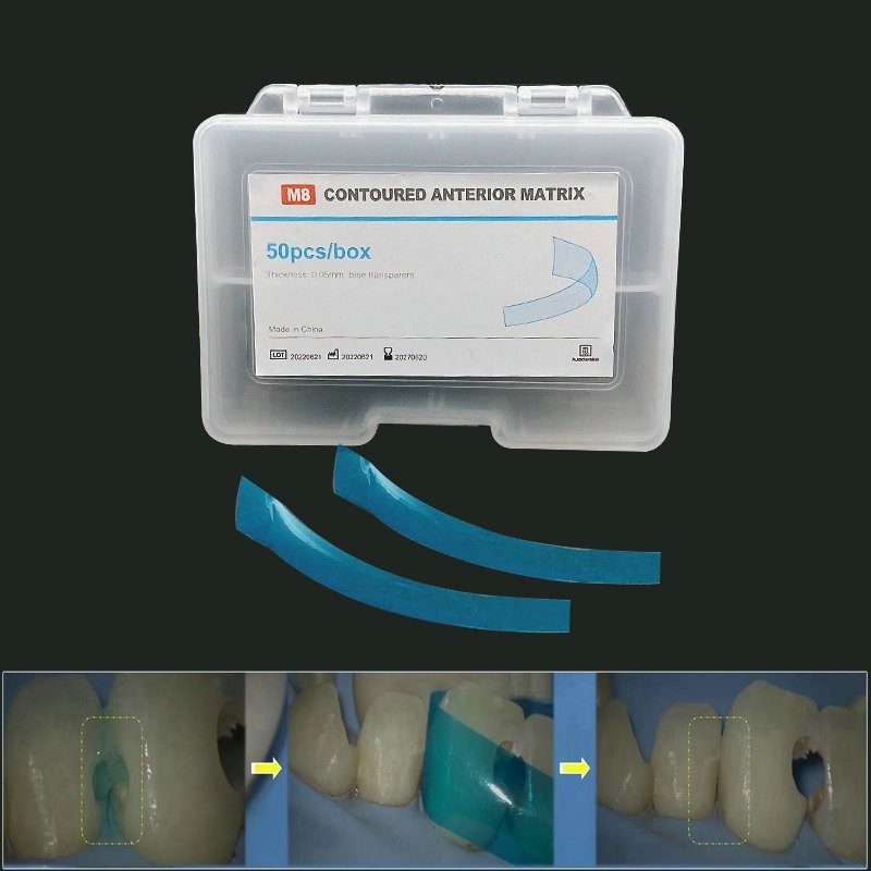Dental Anterior Restoration Matrix Composite Resin Matrices Blue Strip 50Pcs/box