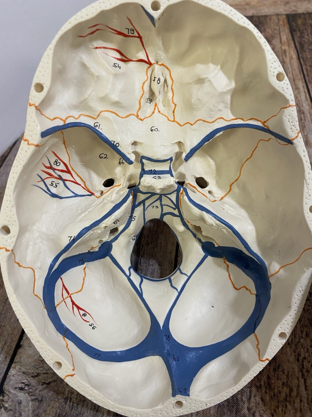 3B Scientific Classic Human Skull Model Opened Detachable Lower Jaw 3 Part