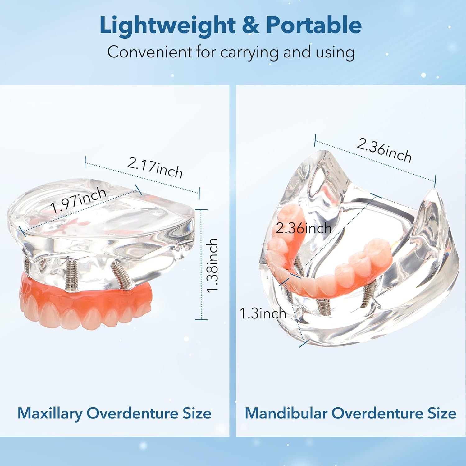 New Dental Implant Model All-on-4 All-on-6 Overdenture U/L Jaw 4/6 Screws Clear