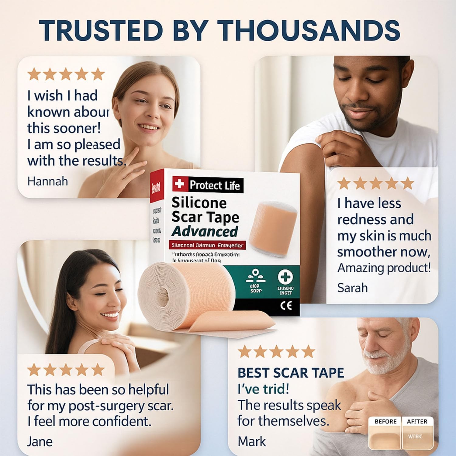Medical Grade Silicone Scar Tape Advanced 1 pack, Beige Improved Formula