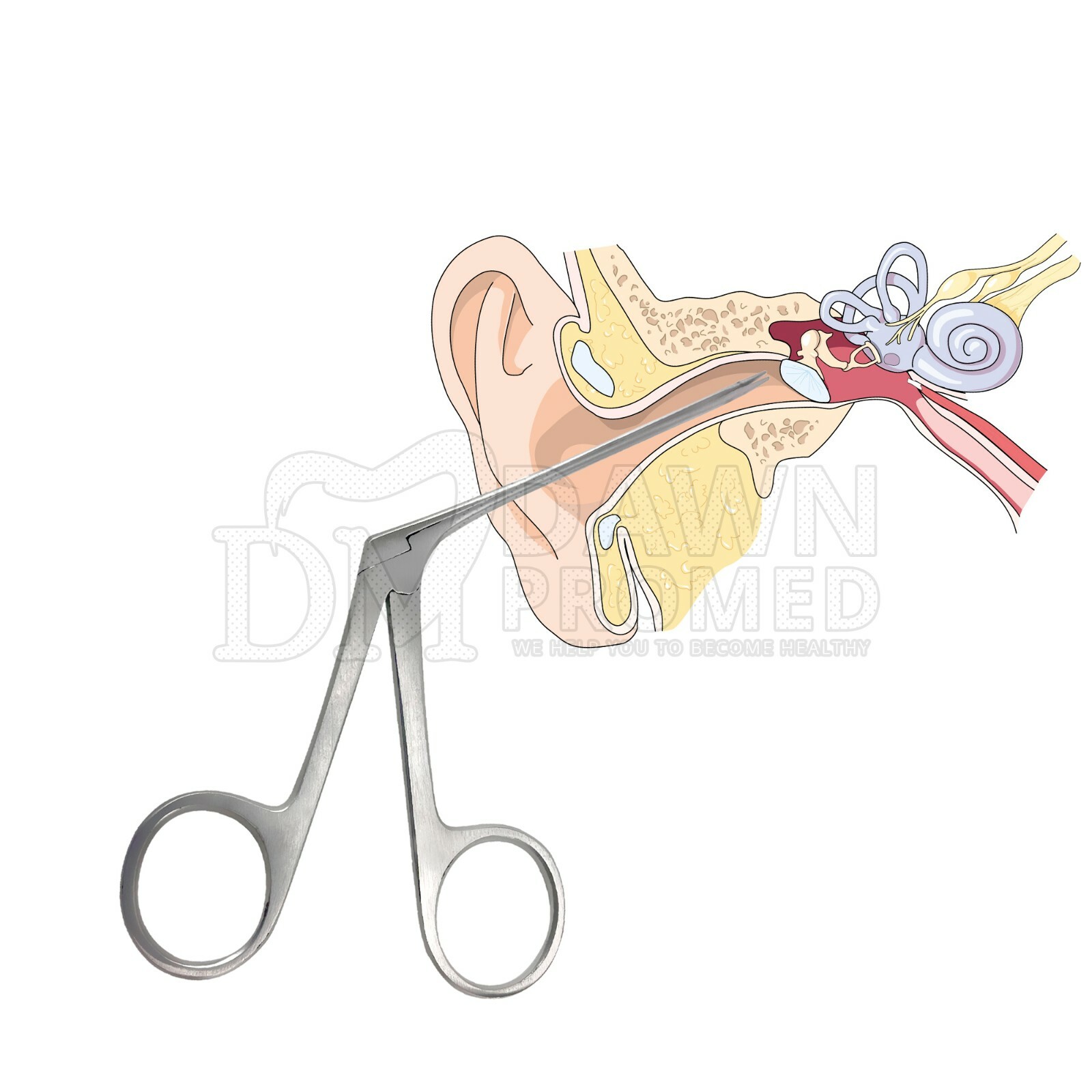 3 Hartman Alligator Ear Forceps 3.5» & 5.5» & 6.5″ Set ENT Inst German Grade