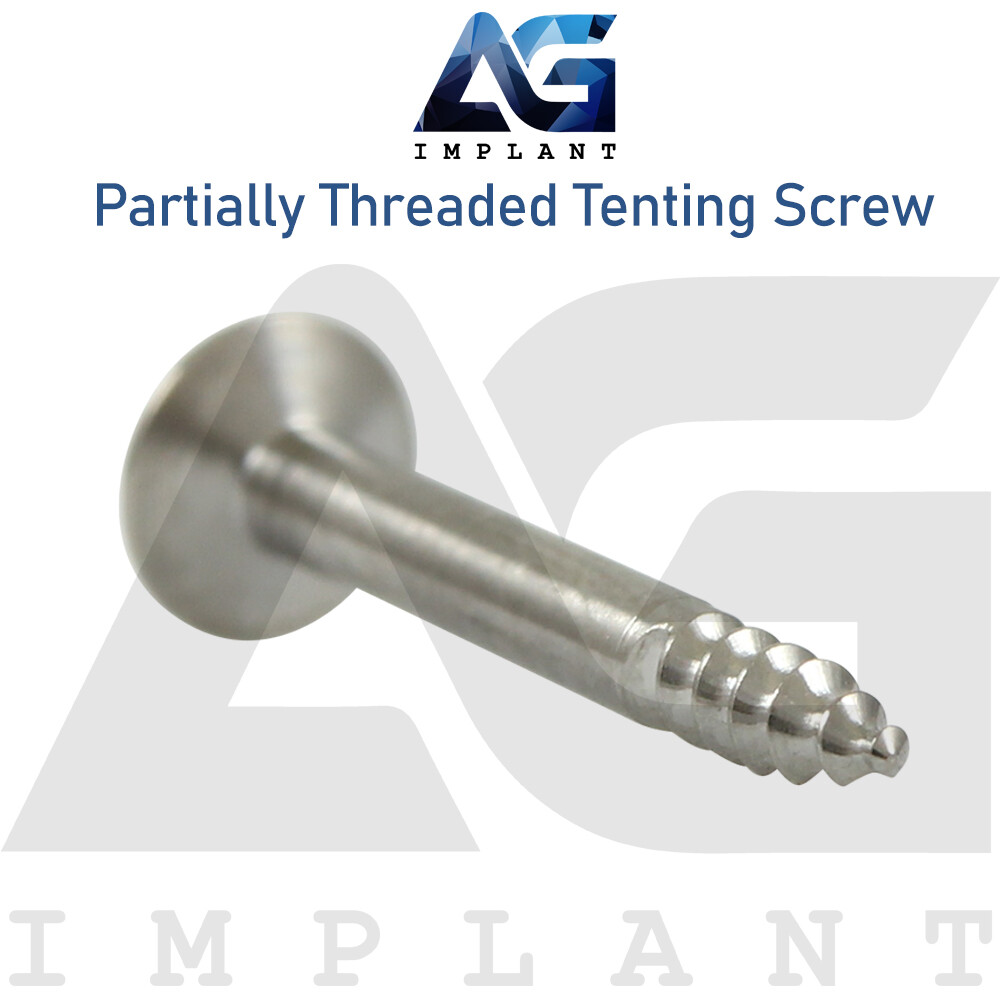 10 Titanium Part Threaded Tenting Screw Guided Regeneration GBR Membrane