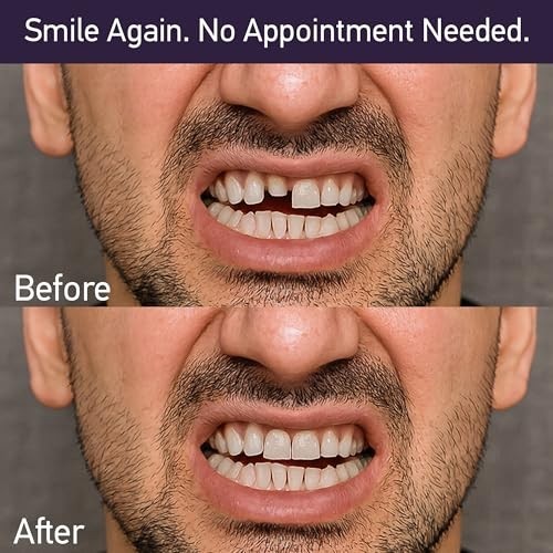 Dental Cement Kit Zinc Oxide Eugenol Temporary Tooth Repair for Crowns & Bridges