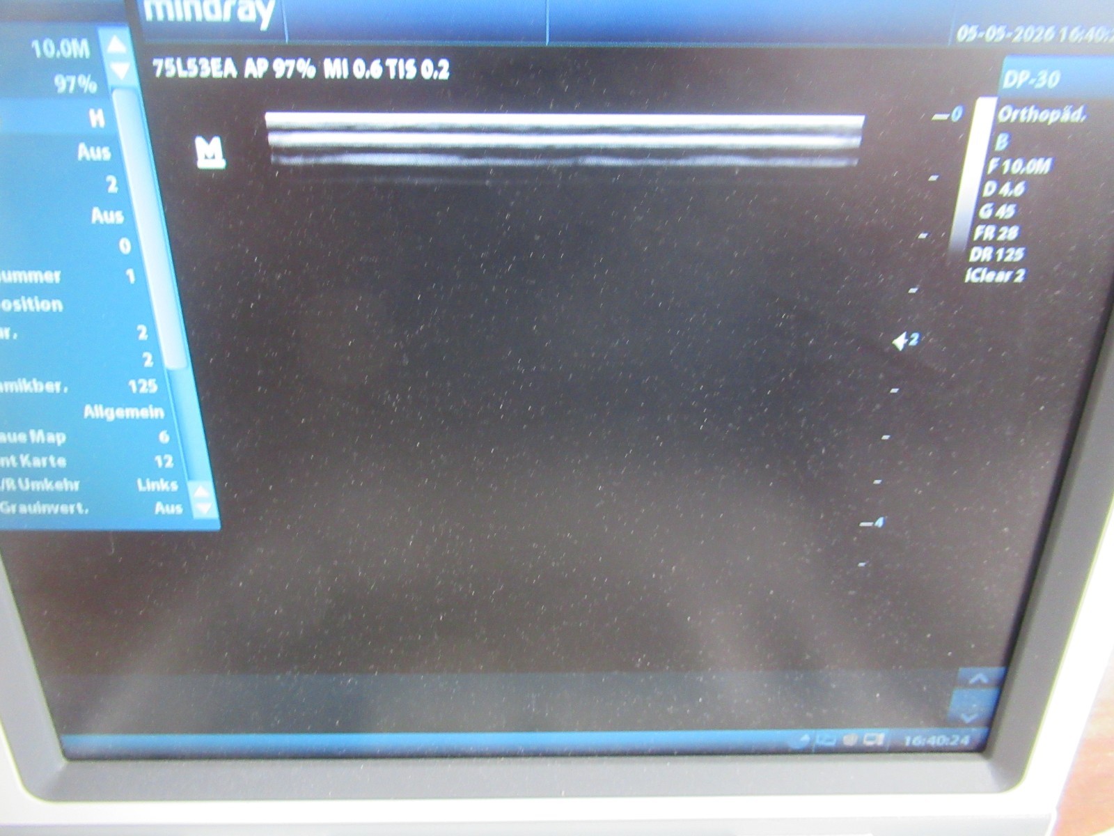 Mindray DP 30 with 75L53EA Linear Probe Portable Ultrasound Machine Very Lightweight