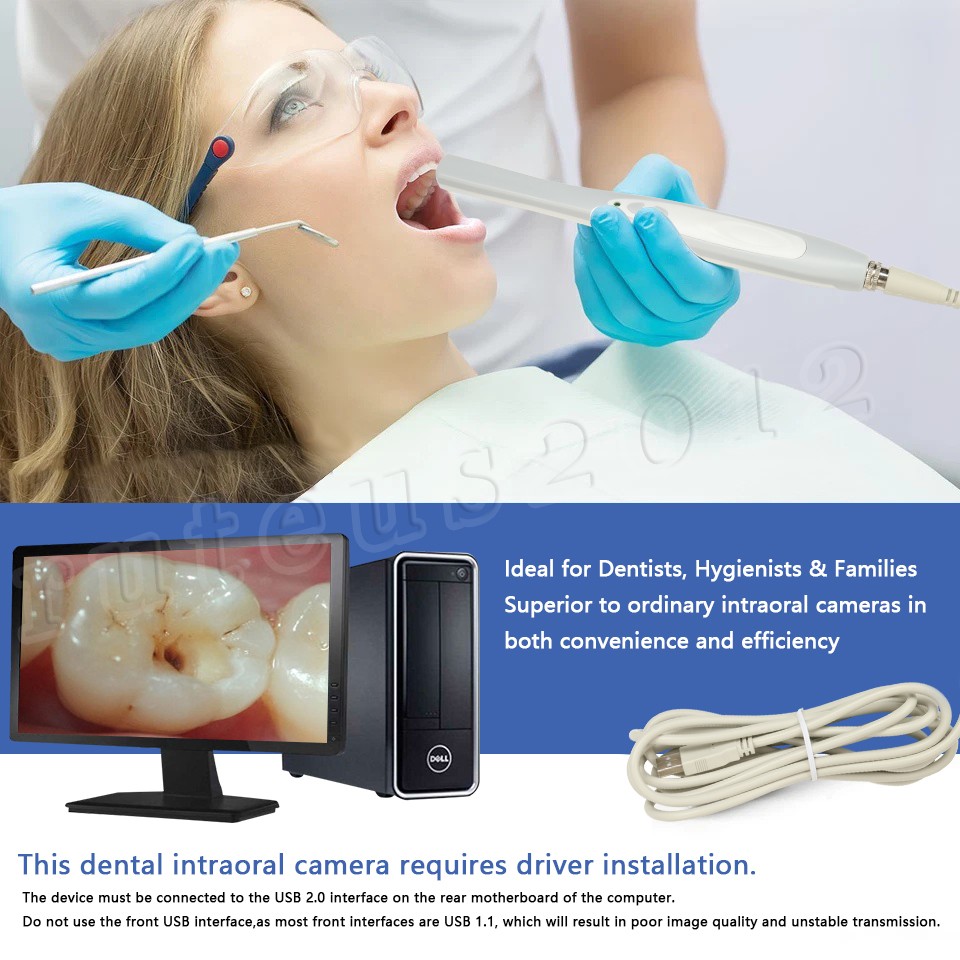 Dental Intraoral Camera High Resolution Endoscope 13MP Tooth Intra Oral Camera