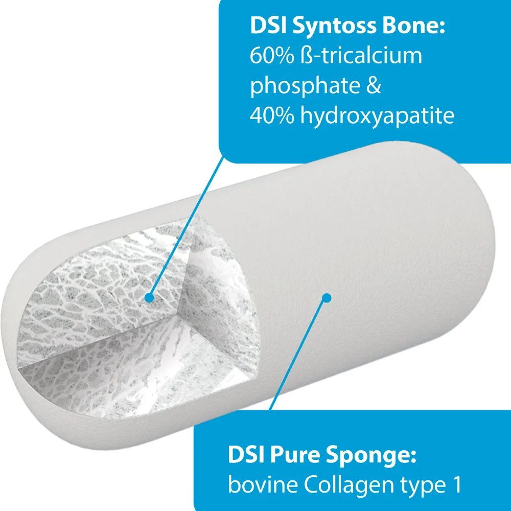 Dental Implant Surgical Sterile Sponge Graft Bone Socket Plug Ø10mm L20mm