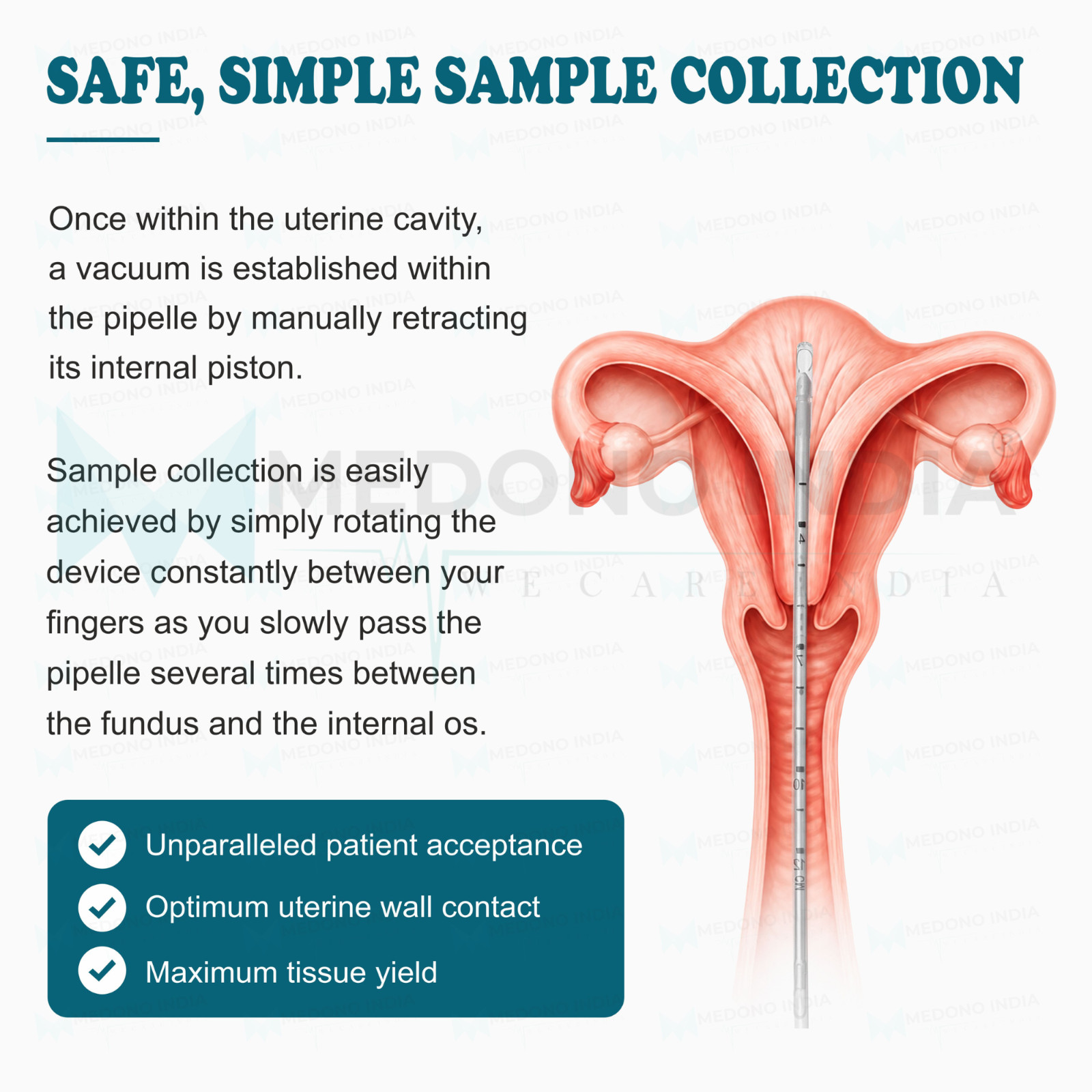 Sterile Pipelle Endometrial Biopsy Curette Disposable Sampling Device Gynecology