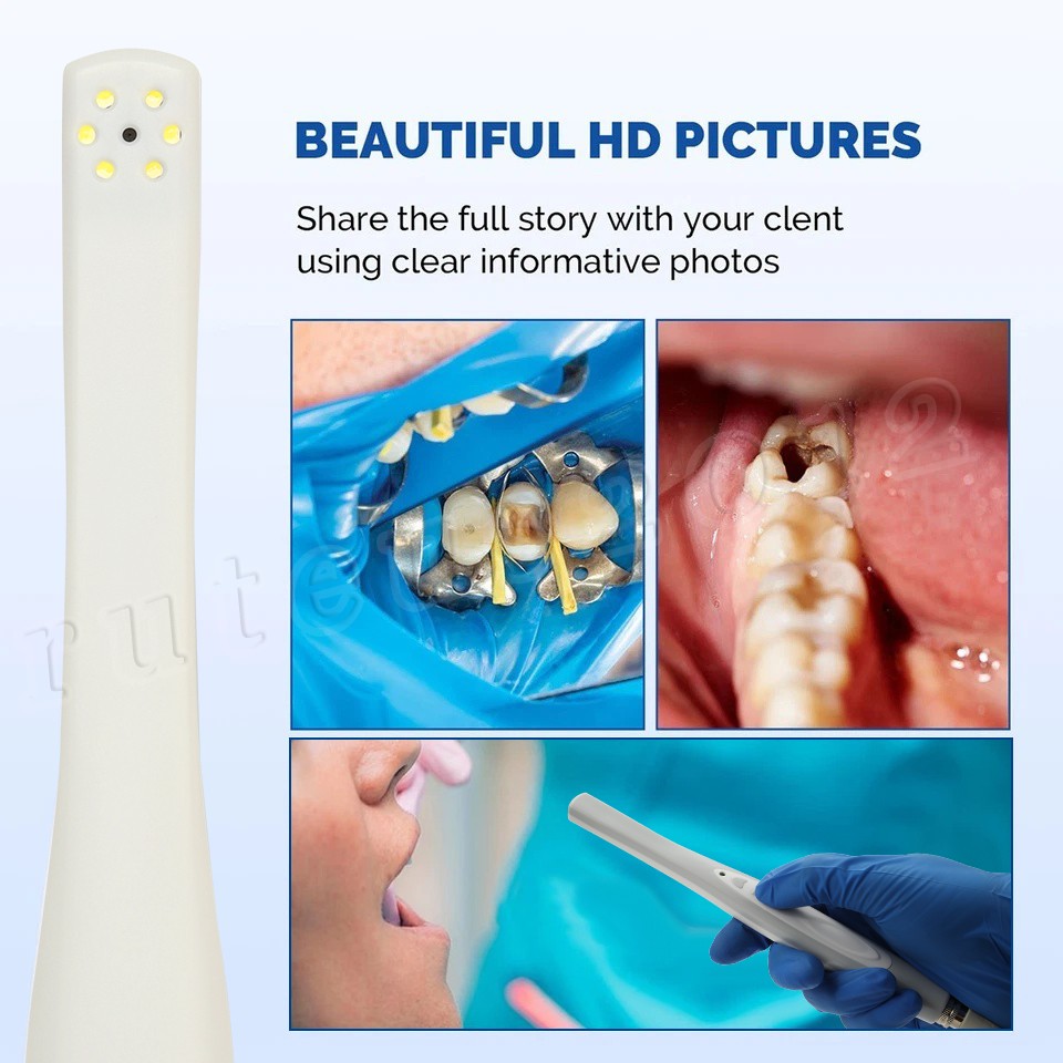 Dental Intraoral Camera High Resolution Endoscope 13MP Tooth Intra Oral Camera