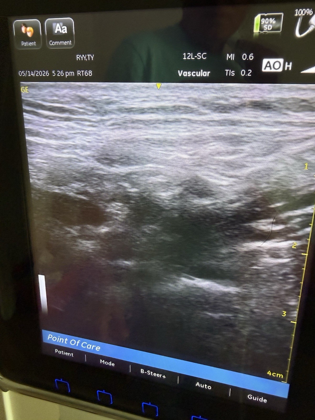 GE Venue 40 Portable Ultrasound Machine w/ 2 Probes + Docking cart 2014