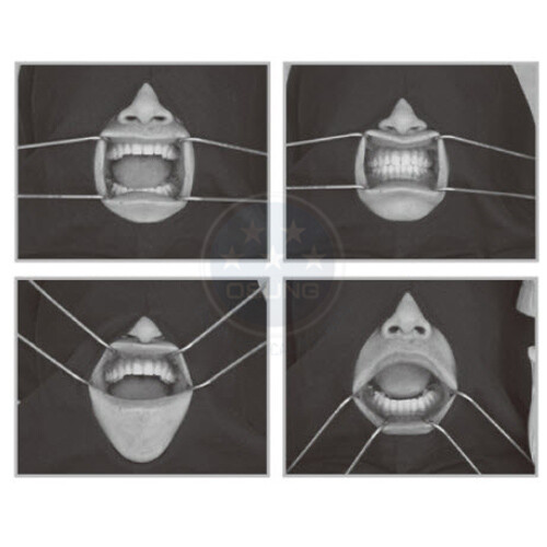 Photographic Intraoral Mouth Mirror with Retractors, Occlusal Small Pedo C-1009
