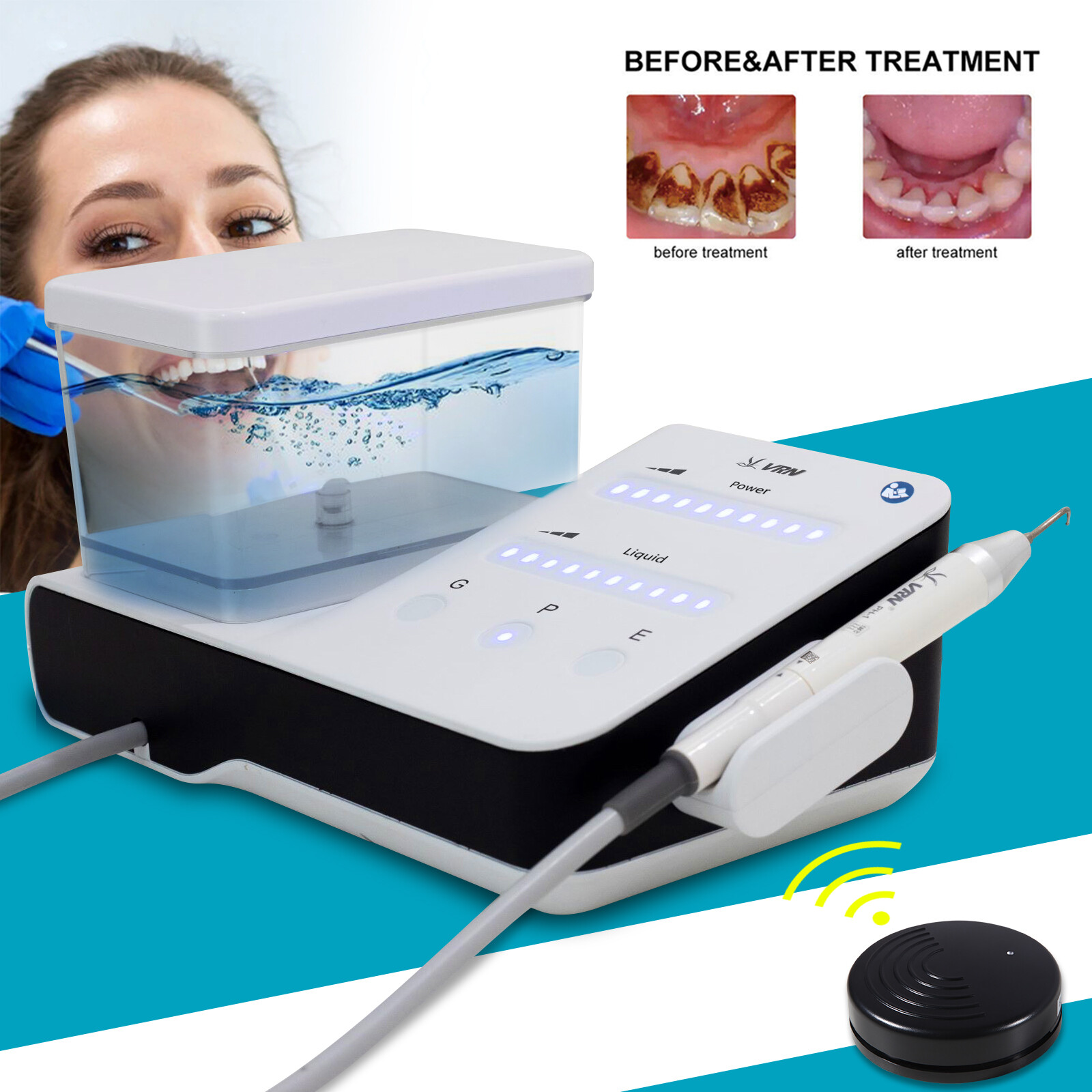 LED Dental Ultrasonic Piezo Scaler Handpiece Bottle Fit EMS Woodpecker + 10*Tips