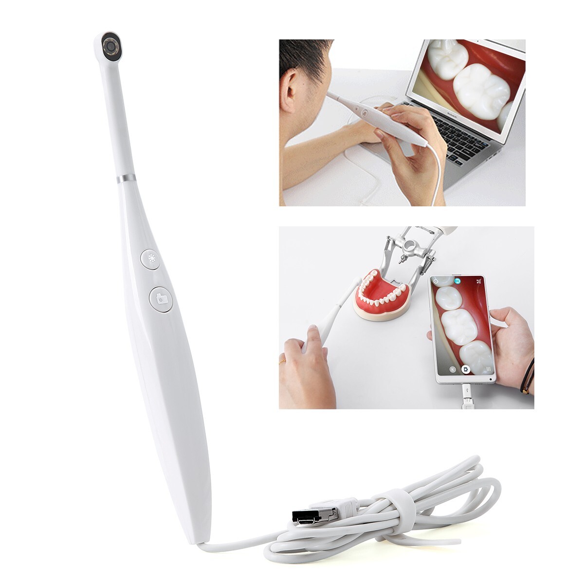 AZDENT Dental USB Intraoral Camera 8 LED Oral Endoscope 3-Speed Adjustment IPX5