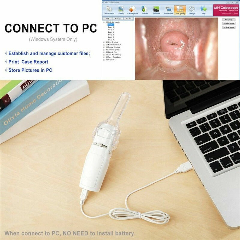 Digital Video Electronic Mini Colposcope FA2 3000000 Pixels Camera NewbKMC