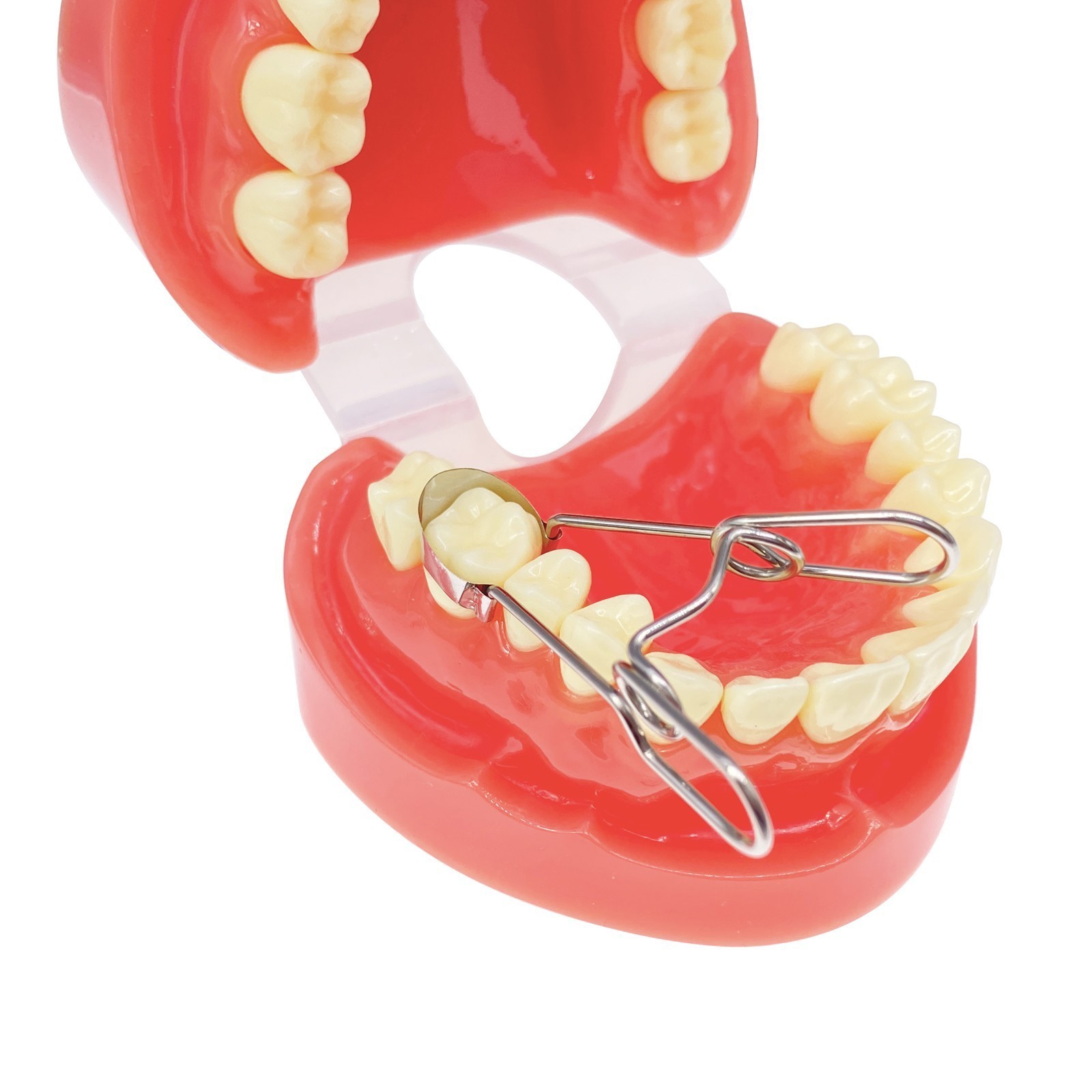 Dental Saddle Contoured Metal Matrices Matrix Band 6 Sizes / Springclip