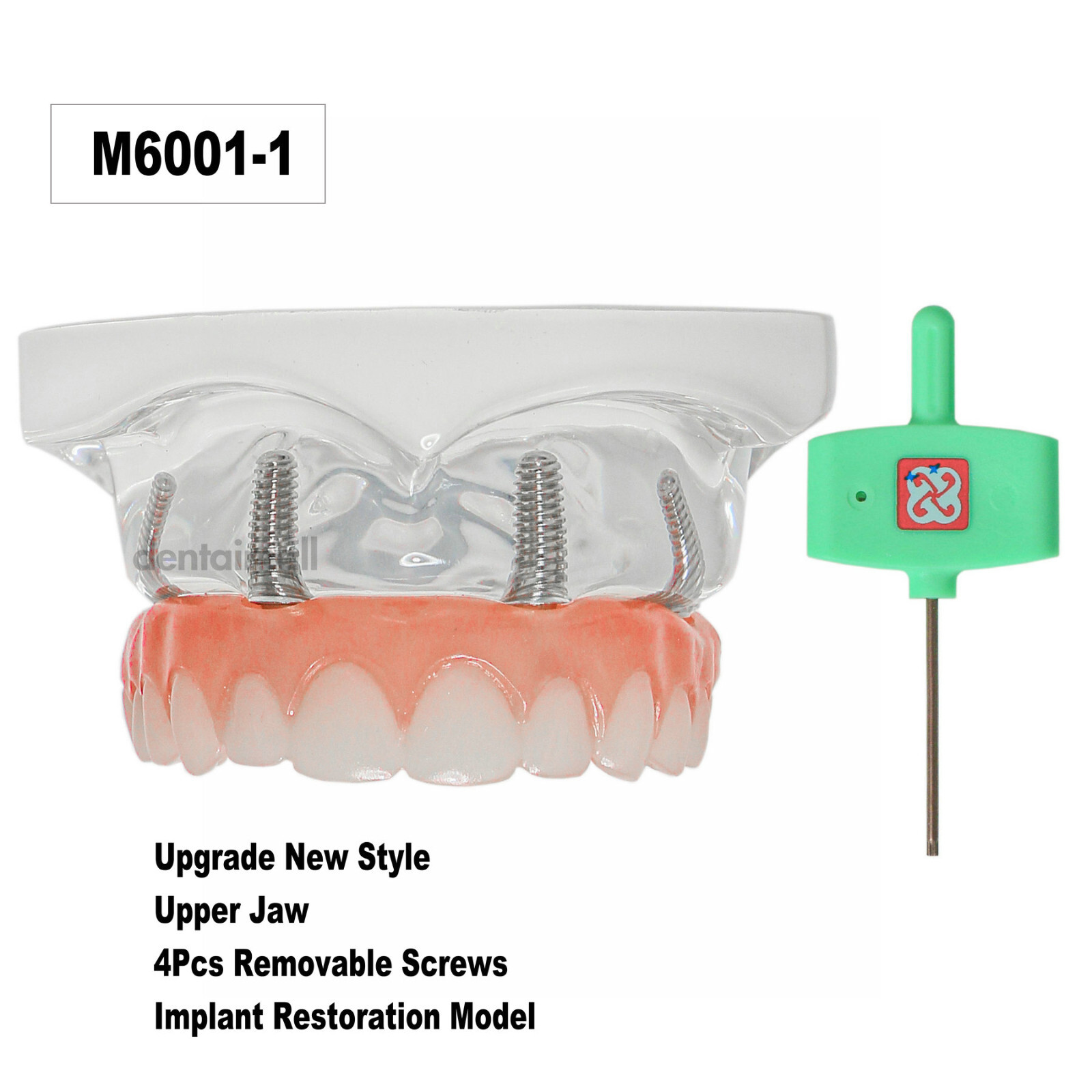 US Dental Overdenture Implant Model All-on-4 With 4 Screw Upper/Lower Clear Jaw